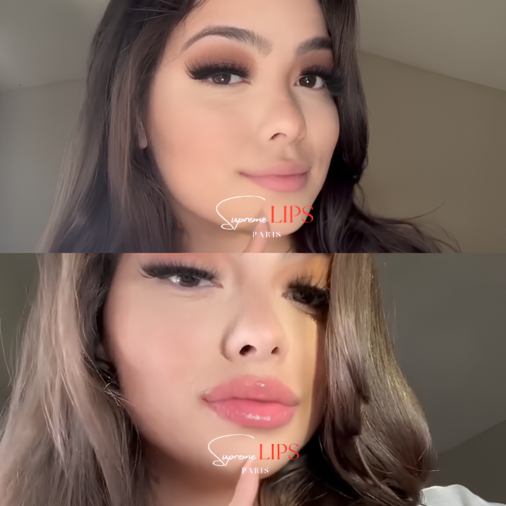 PACK PERFECT LIPS 1 Repulpeur + 1 Encre à Lèvres (KISS ou BLOOM)